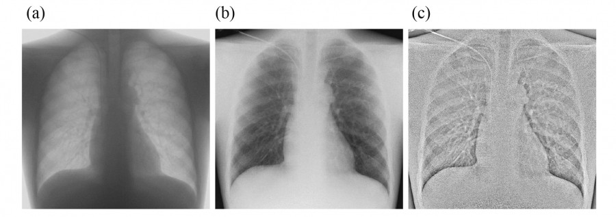 X-ray images of a chest phantom showing different imaging techniques: (a) fluoroscopy, (b) low-dose conventional, and (c) high spatial frequency enhancement.