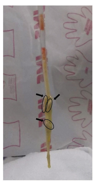 Medical tube with markings, placed on a white surface, against a background of patterned paper.