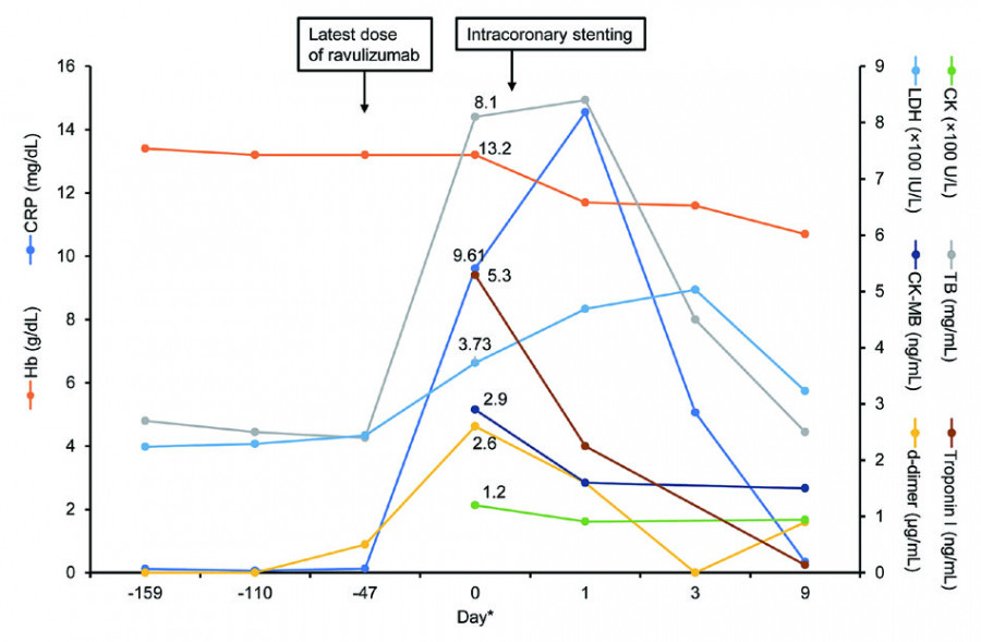 Graph showing clinical data over time for a patient treated with ravulizumab, including levels of hemoglobin, CRP, and cardiac markers.