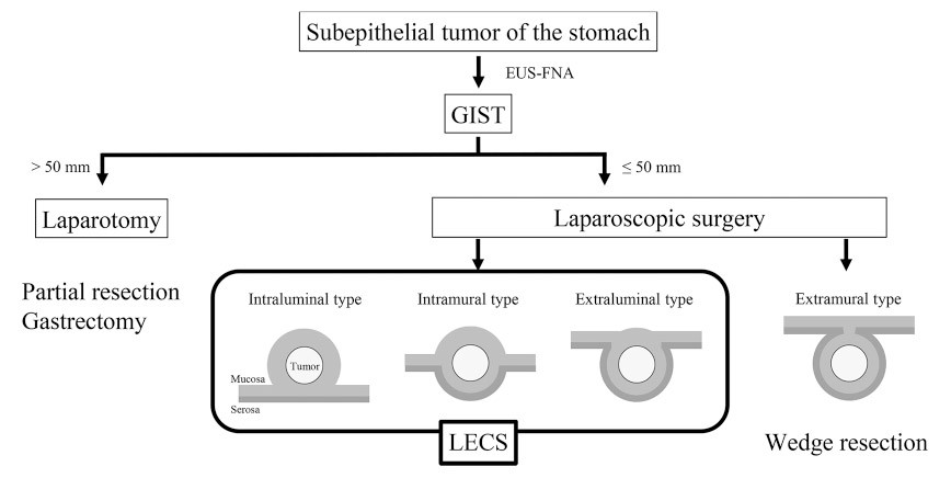 Surgical treatment algorithm for gastric gastrointestinal stromal tumors, illustrating laparotomy and laparoscopic options.