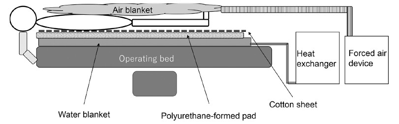 Diagram illustrating a medical operating bed setup with various heating elements, including air and water blankets.