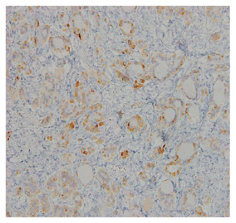 Microscopic view of tissue sample showing various cell structures and staining patterns.