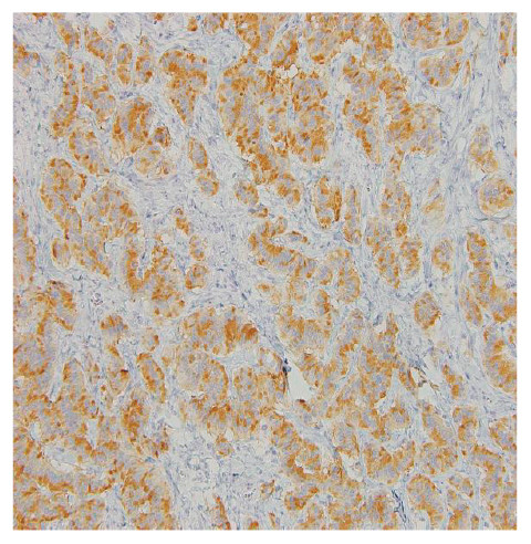 Microscopic view of tissue sample showing distinct cellular patterns and staining variations.