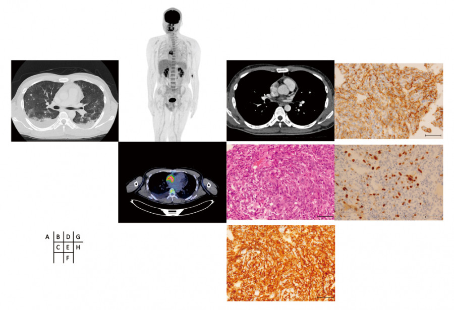 Medical imaging collage featuring CT scans, histological slides, and a body outline for diagnostic purposes.