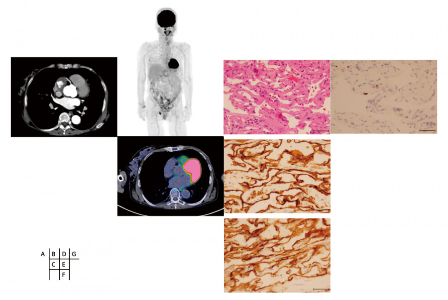 Medical imaging collage featuring a CT scan, histological slides, and a human silhouette, illustrating various diagnostic techniques.