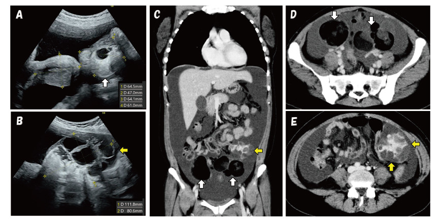 Medical imaging scans showing various views of internal organs, including ultrasound and CT images.