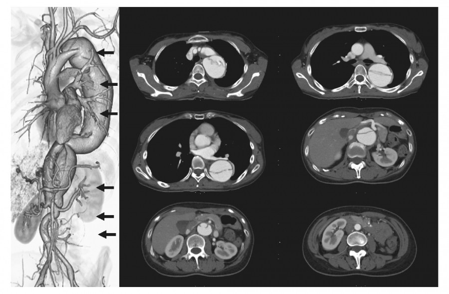 Medical imaging comparison showing a detailed illustration of the heart and CT scans of the thoracic region.