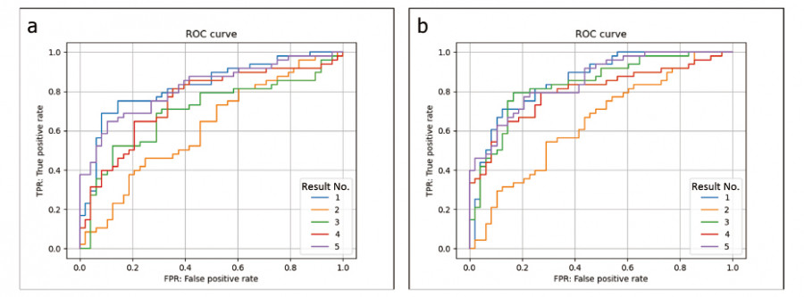 ROC curves comparing type A and type B datasets for pulmonary nodule detection in chest radiography.