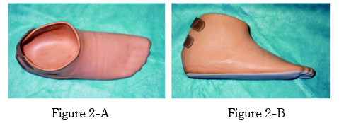 Foot prosthesis shown from overhead (Figure 2-A) and side view (Figure 2-B), featuring a rubber tip and thick sole.