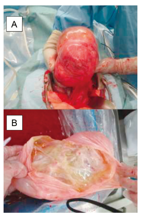 Medical procedure images showing surgical techniques and anatomical structures.