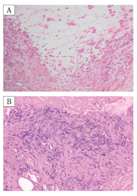 Histological images showing tissue samples with varying cellular structures and staining patterns.