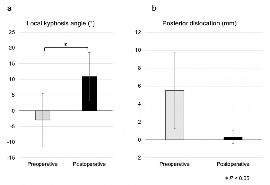 Graph comparing local kyphosis angle and posterior dislocation measurements before and after surgery.