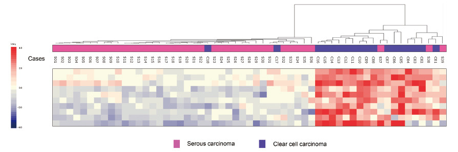 Heatmap displaying data on serous and clear cell carcinoma cases, highlighting differences in expression levels.