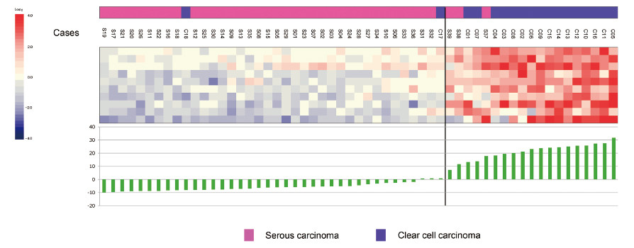 Gene expression scoring system comparing ovarian serous carcinoma and clear cell carcinoma samples, with color-coded bars indicating scores.