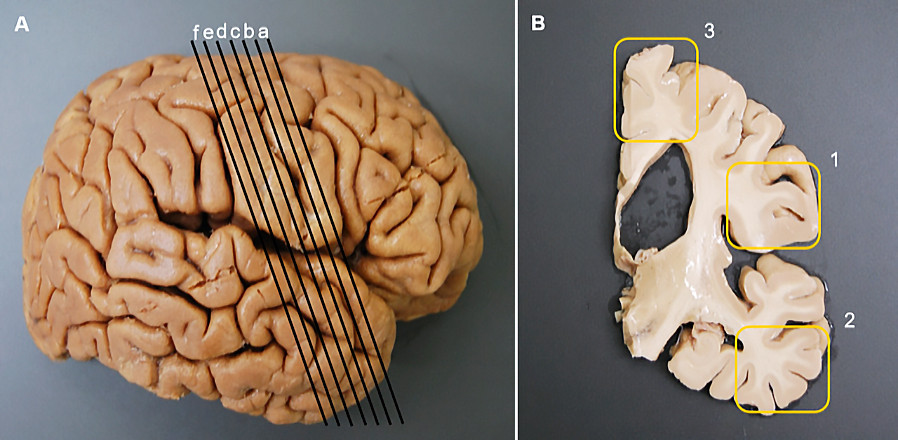 An anatomical model of a human brain, showing detailed surface features and labeled sections for study.