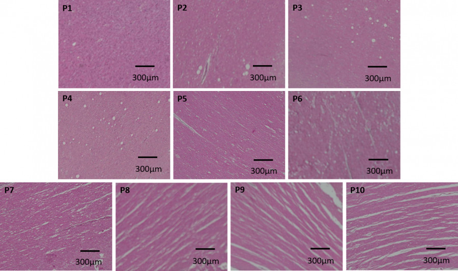 Hematoxylin-eosin stained brain samples showing various freezing protocols, highlighting ice crystal formation in specific samples.