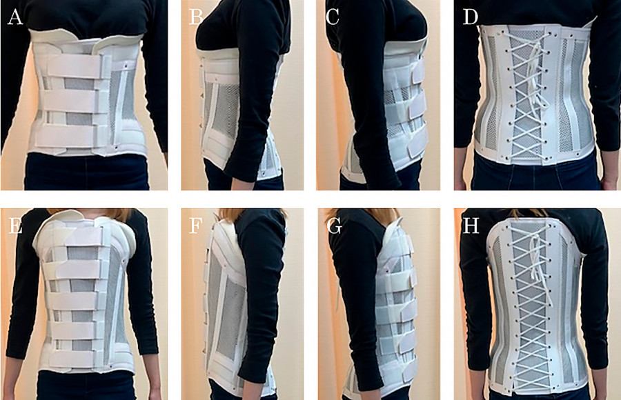 Images of patients wearing short and long Damen corsets from various angles, showcasing the orthotic design.