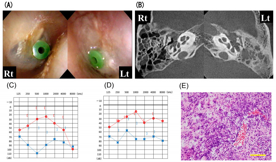 Medical images showing ocular examinations and histological analysis related to eye health.