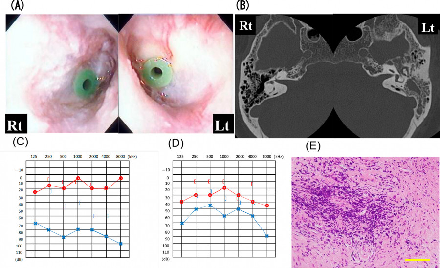 Medical images showing endoscopic views of the nasal cavity, with graphs and histological slides for analysis.