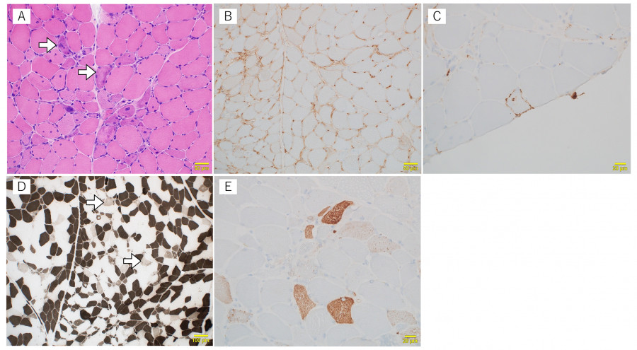 Microscopic images showing various tissue samples with distinct staining patterns, highlighting cellular structures and morphology.