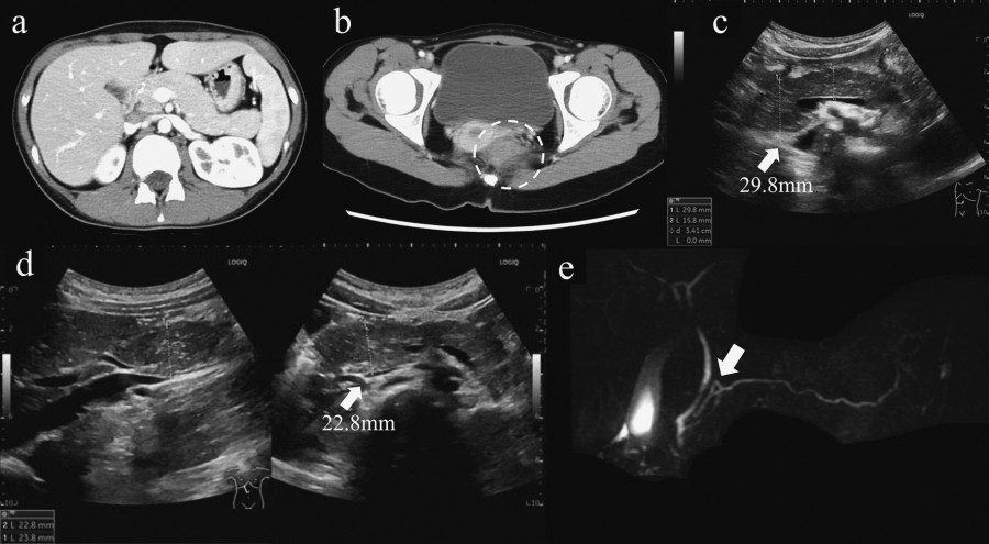 Medical imaging series showing various ultrasound and CT scans with measurements indicated.