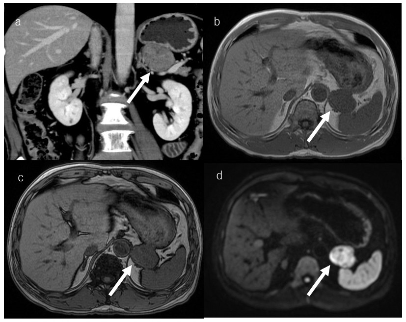 Medical imaging showing various views of abdominal organs with highlighted areas of interest.