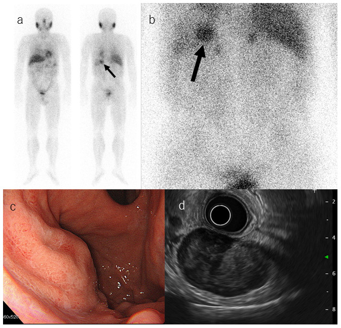 Medical imaging results showing various diagnostic techniques, including scans and endoscopic views.