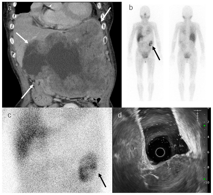 Medical imaging results showing various scans, including CT and ultrasound, highlighting specific areas of interest.