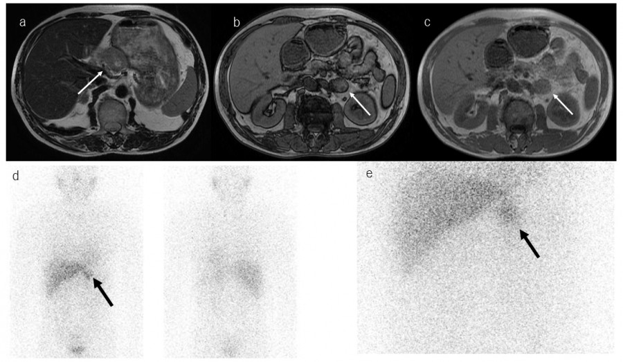 Medical imaging scans showing various views of abdominal organs, highlighting specific areas of interest.