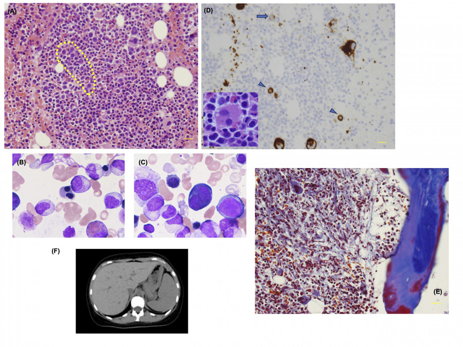 Histological images showing various cell types and tissue structures, including stained sections and a CT scan of the abdomen.