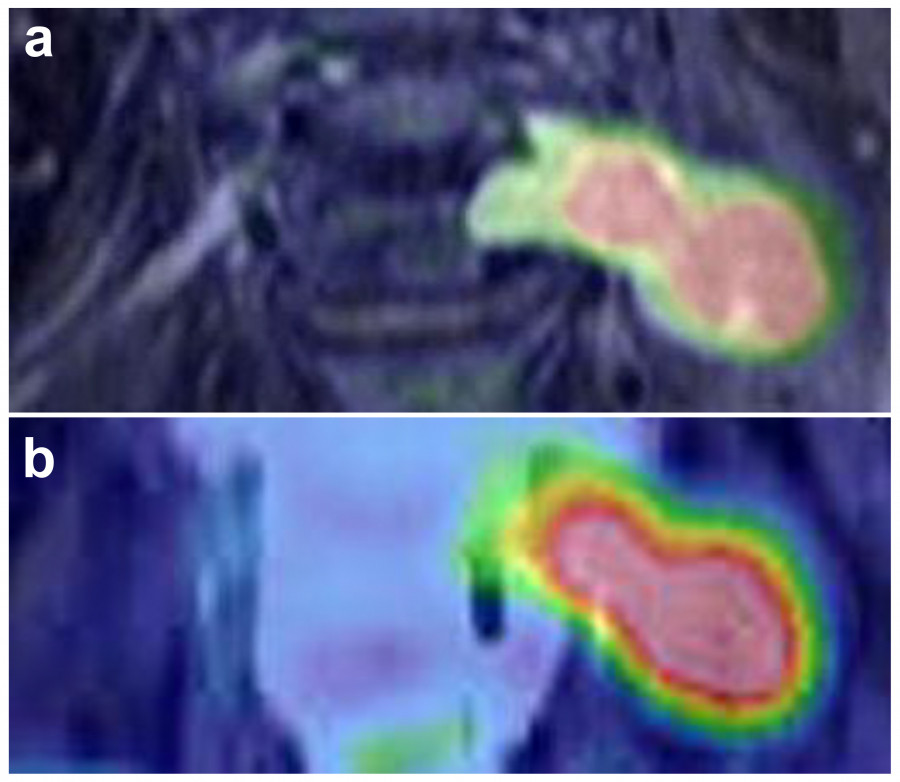 Abstract images showing two distinct shapes with varying color gradients, likely representing data or research findings.