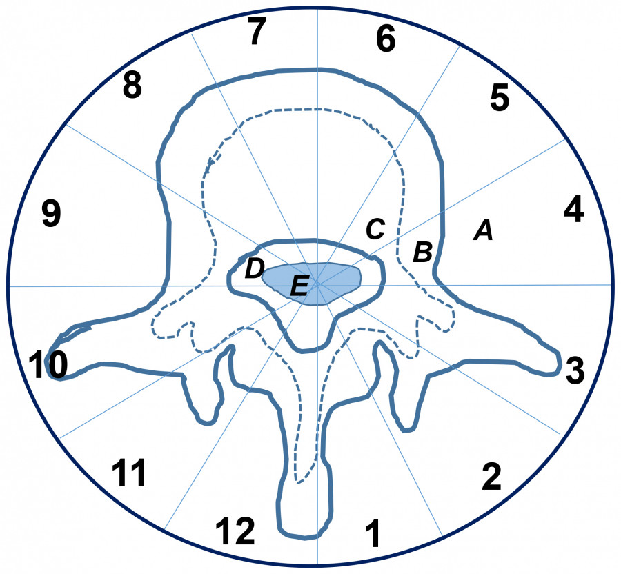 Diagram of a vertebra with labeled sections, illustrating anatomical features for educational purposes.