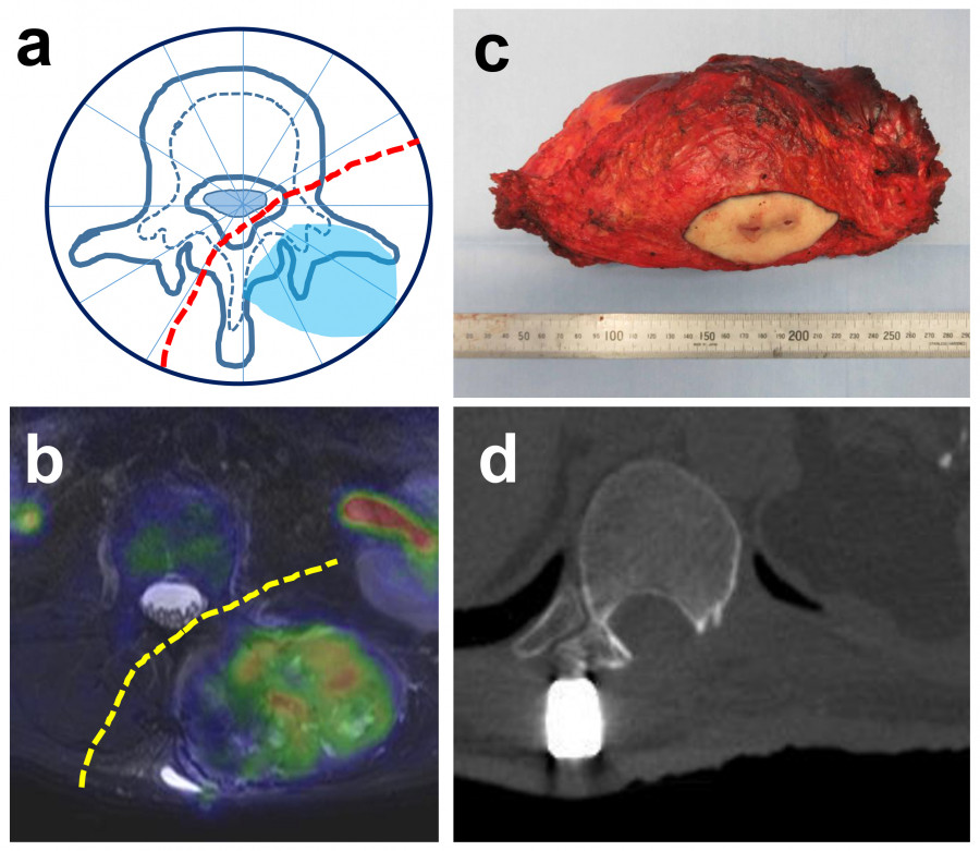 Illustration of anatomical structures related to medical research, including diagrams and images of specimens.