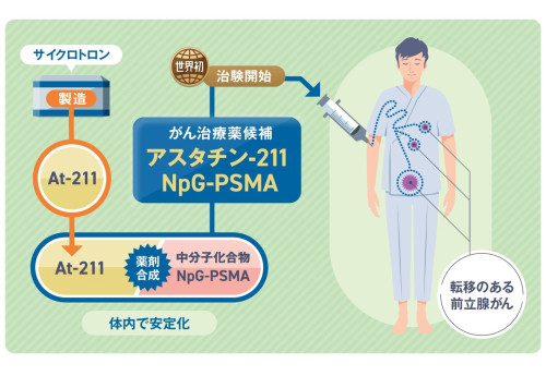 前立腺がん治療の新しい可能性 ― 放射線治療薬候補の治験