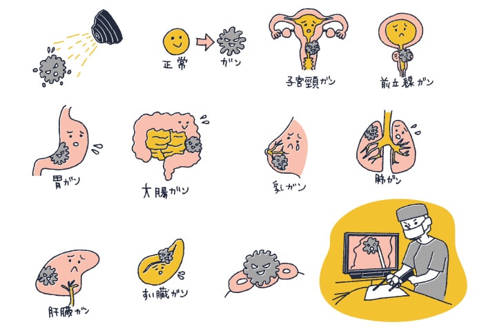 がん治療イメージ