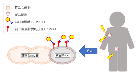 }1:PSMA PET̎dg