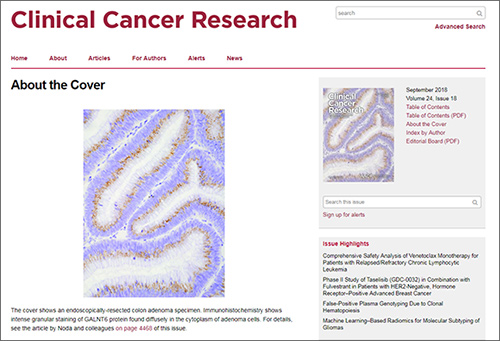 野田助教らの研究が表紙を飾ったことを伝えるClinical Cancer Researchのホームページ
